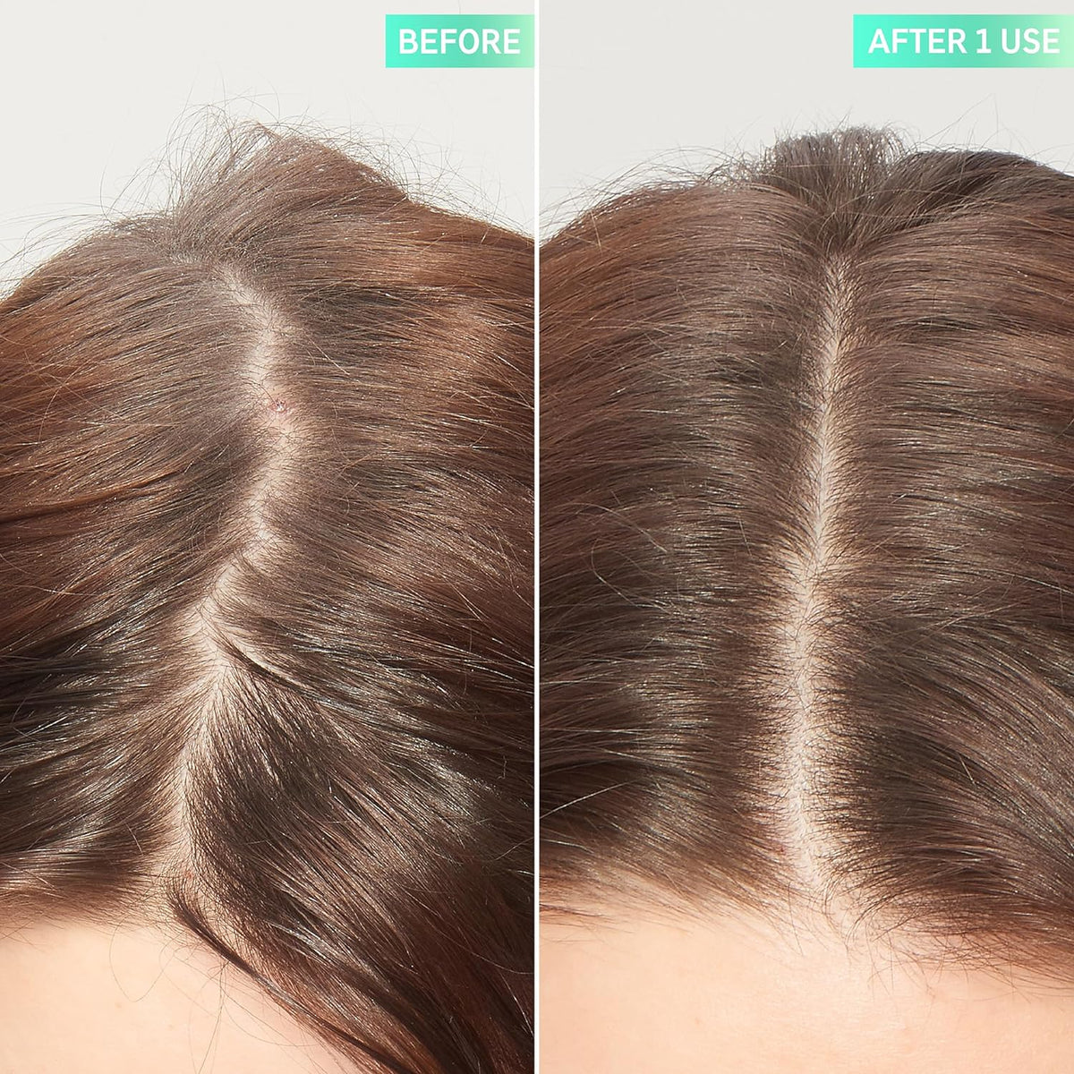 Inkey List 7% Glycolic Acid Exfoliating Scalp Scrub